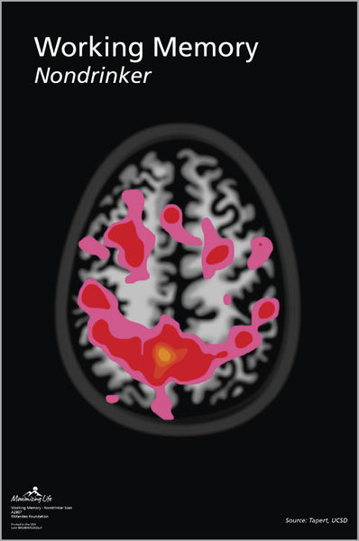 Working Memory Scan - Nondrinker