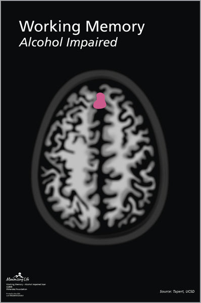Working Memory Scan - Alcohol Impaired