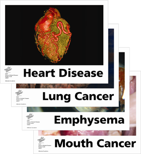 Tobacco Related Disease Display Cards